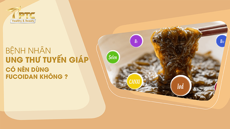 bệnh nhân ung thư ung thư tuyến giáp được dùng Fucoidan không