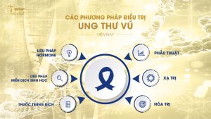 điều trị ung thư vú