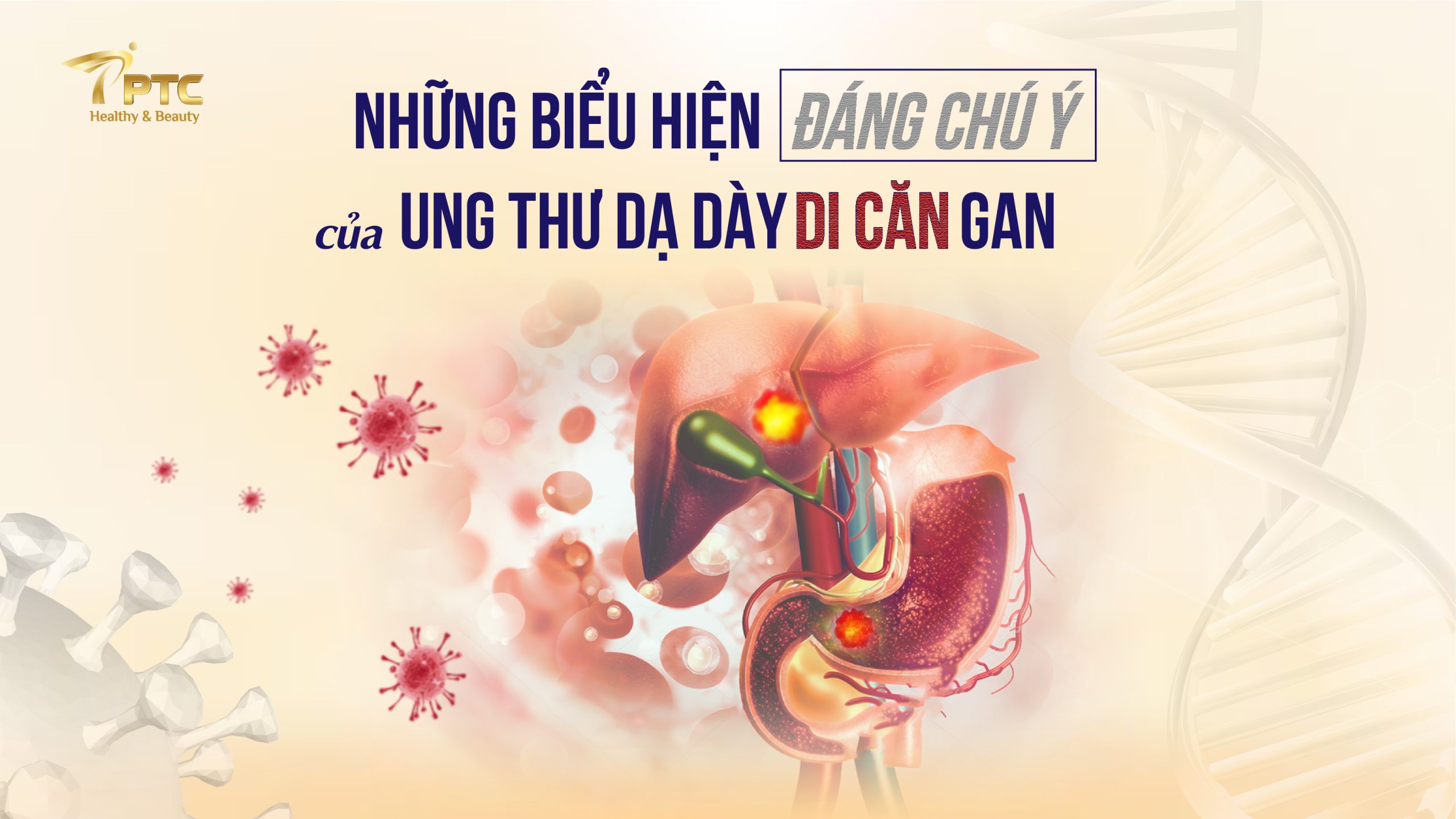 Biểu hiện của ung thư dạ dày di căn gan