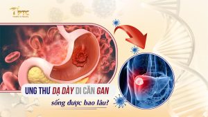 ung thư dạ dày di căn gan