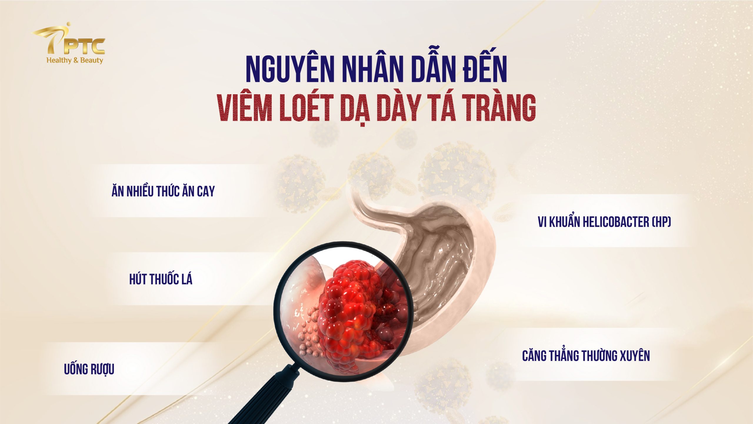 Nguyên nhân vẫn đến viêm loét dạ dày tá tràng