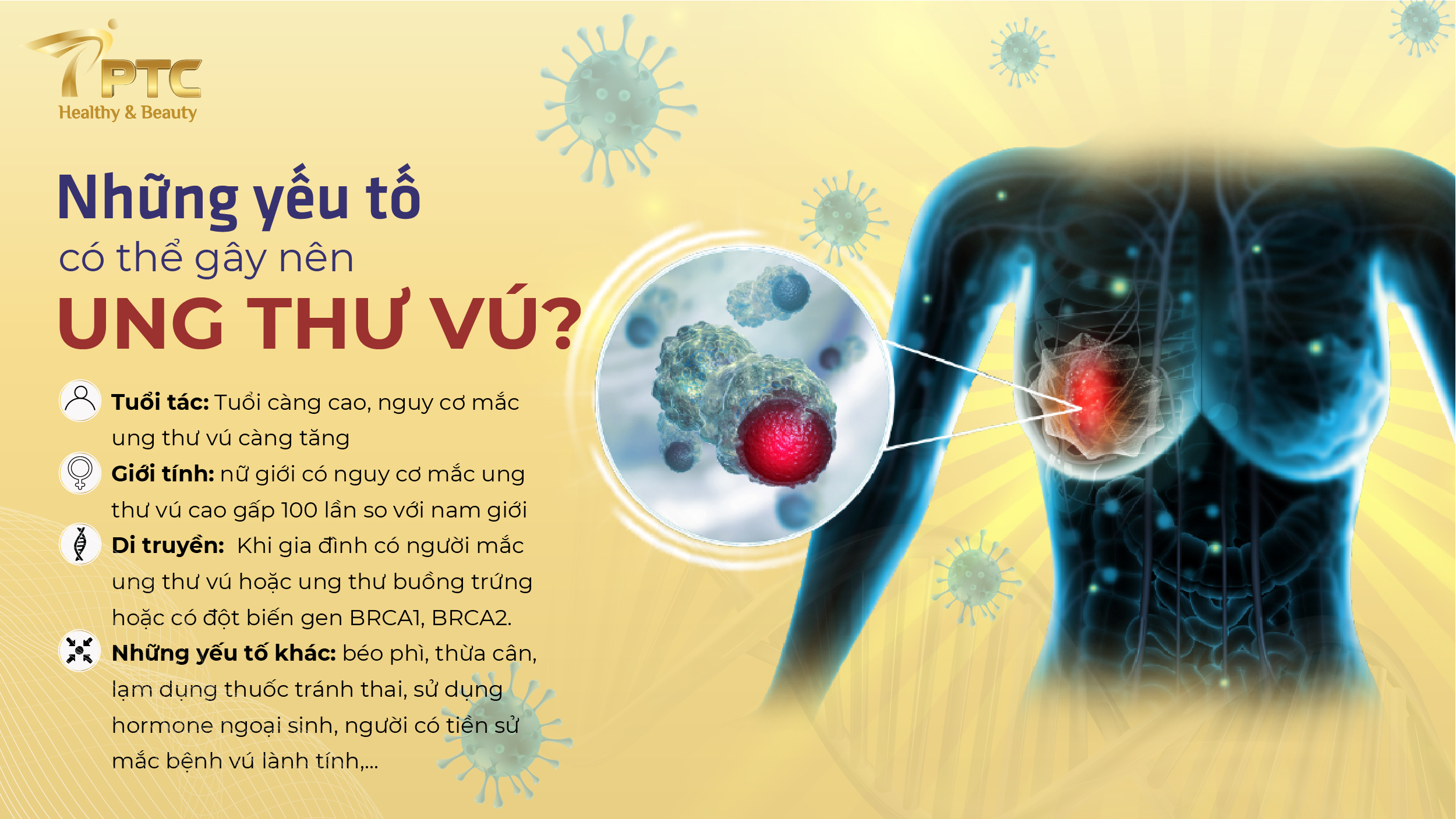 Ung thư vú là gì? Các nguyên nhân gây ra ung thư vú