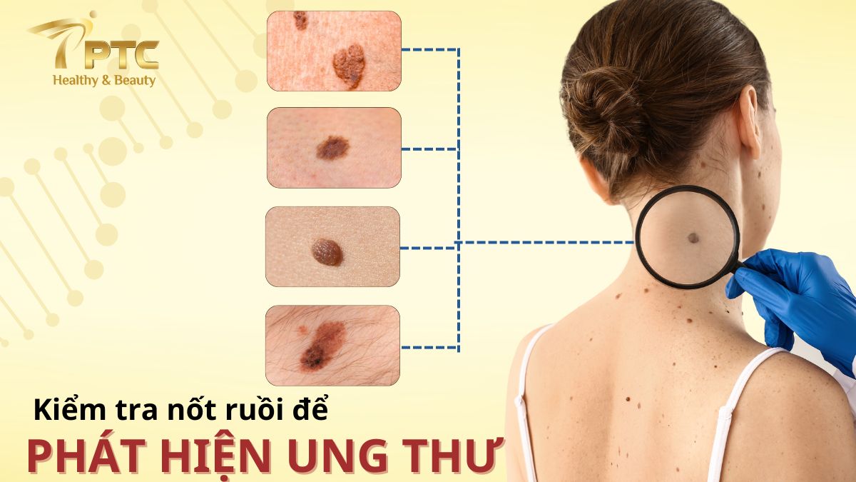 not-ruoi-canh-bao-ung-thu