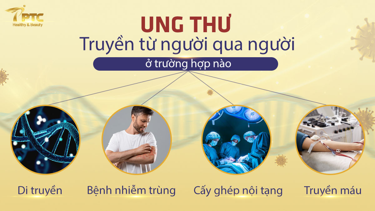ung thư có lây không?