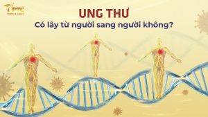 ung thư có lây không