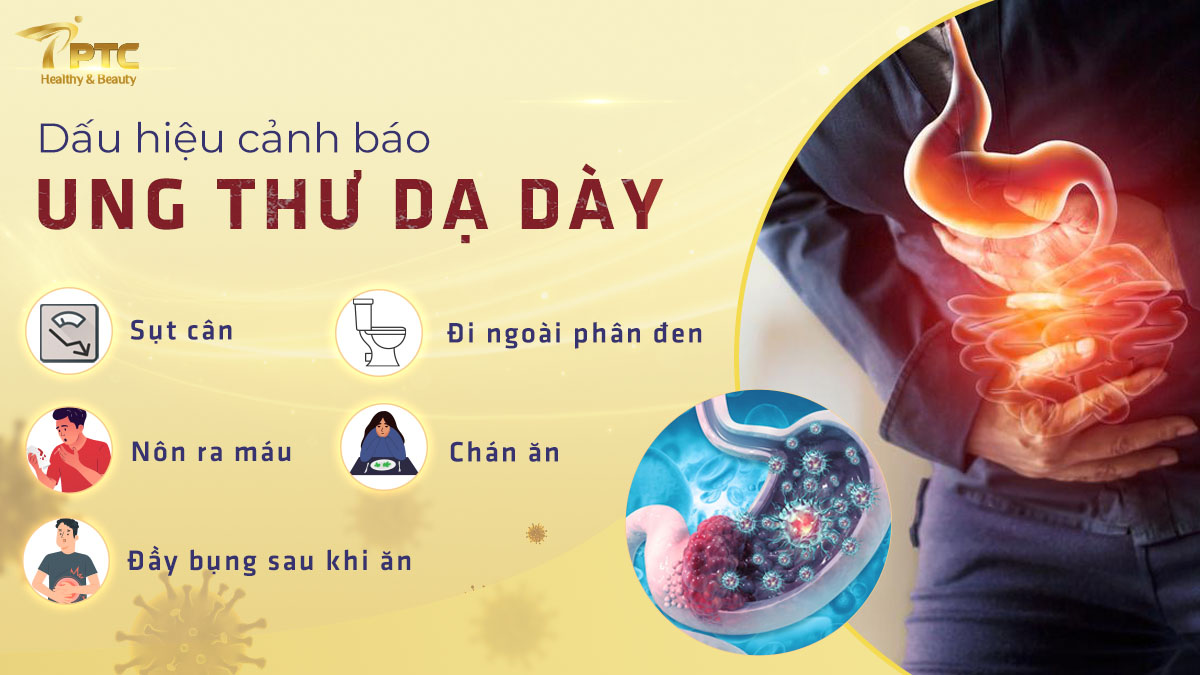 nhung-dau-hieu-canh-bao-ung-thu-da-day-can-luu-y