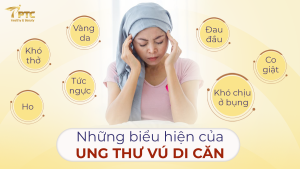 ung thư vú di căn