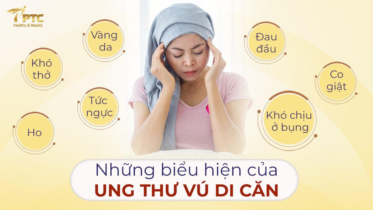 Ung thư vú di căn đến đâu và triệu chứng
